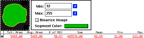 02_segmentation.gif (4667 bytes)
