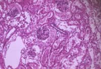 Kohler_start.jpg (9093 bytes)