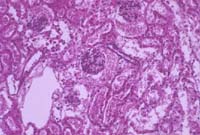 kohler_open_field_dia.jpg (9487 bytes)